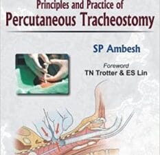 principles and practice of percutaneous tracheostomy 1st edition
