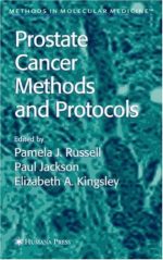 prostate cancer: methods and protocols