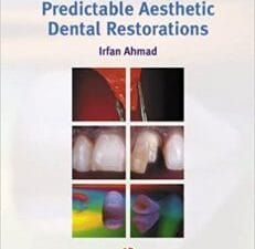 Protocols for Predictable Aesthetic Dental Restorations 1st Edition