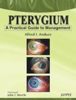 pterygium – a practical guide to management 1st edition