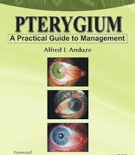 pterygium – a practical guide to management 1st edition