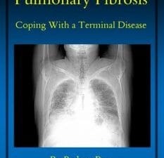 pulmonary fibrosis: coping with a terminal disease