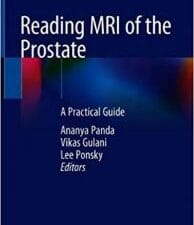 reading mri of the prostate: a practical guide