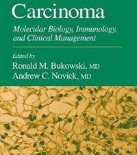 renal cell carcinoma: molecular biology, immunology, and clinical management (current clinical oncology)