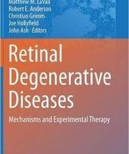 retinal degenerative diseases: mechanisms and experimental therapy