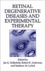 retinal degenerative diseases and experimental therapy