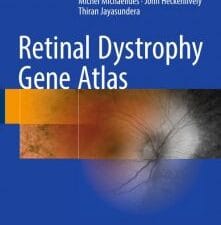 retinal dystrophy gene atlas