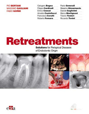 retreatment. solutions for apical diseases of endodontic origin