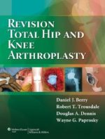 revision total hip and knee arthroplasty 1st edition