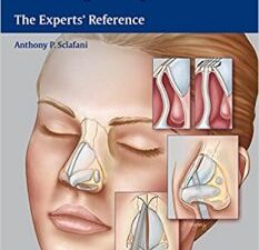 rhinoplasty: the experts’ reference 1st edition
