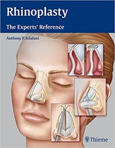 rhinoplasty: the experts’ reference 1st edition
