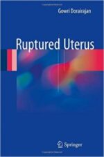 ruptured uterus