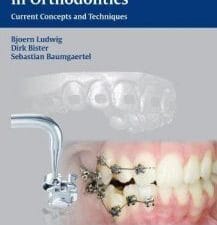 Self-ligating Brackets in Orthodontics