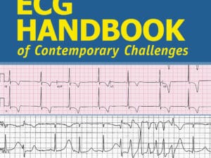 ECG Handbook of Contemporary Challenges