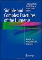 simple and complex fractures of the humerus: a guide to assessment and treatment