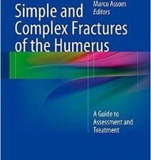simple and complex fractures of the humerus: a guide to assessment and treatment