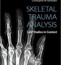 skeletal trauma analysis: case studies in context 1st edition