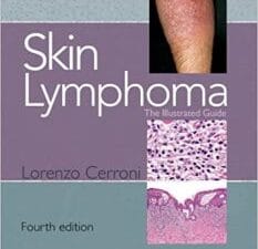 Skin Lymphoma: The Illustrated Guide 4th Edition