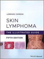 skin lymphoma: the illustrated guide 5th edition, kindle edition