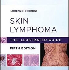 skin lymphoma: the illustrated guide 5th edition, kindle edition