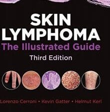 Skin Lymphoma: The Illustrated Guide, Third Edition