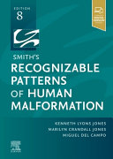 smith’s recognizable patterns of human malformation 8th edition