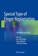 special type of finger replantation: techniques and cases