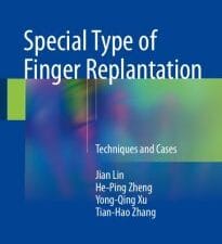 special type of finger replantation: techniques and cases