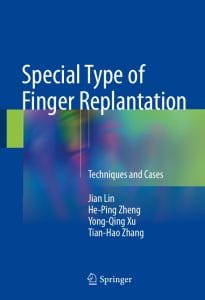 special type of finger replantation: techniques and cases
