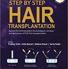 Step by Step Hair Transplantation: Expand the Dermatologist’s Knowledge on Concepts and Techniques of Fue Hair Transplantation 1st Edition