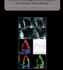 Stress Echocardiography: Its Role in the Diagnosis and Evaluation of Coronary Artery Disease