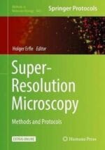super resolution microscopy: methods and protocols