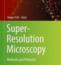super resolution microscopy: methods and protocols