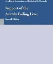 support of the acutely failing liver (tissue engineering intelligence unit)