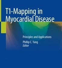 t1 mapping in myocardial disease: principles and applications