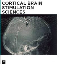 textbook of cortical brain stimulation