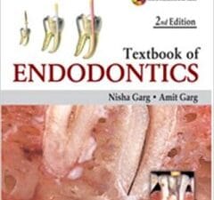 Textbook of Endodontics 2nd Edition