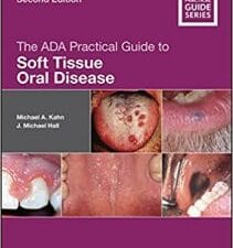 The ADA Practical Guide to Soft Tissue Oral Disease, 2nd edition