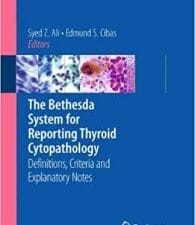 the bethesda system for reporting thyroid cytopathology: definitions, criteria and explanatory notes