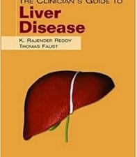 the clinician’s guide to liver disease (the clinician’s guide to gi series)