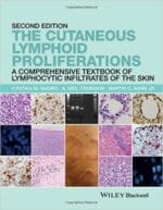 the cutaneous lymphoid proliferations: a comprehensive textbook of lymphocytic infiltrates of the skin, 2nd edition