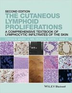 the cutaneous lymphoid proliferations: a comprehensive textbook of lymphocytic infiltrates of the skin 2nd edition