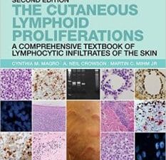 the cutaneous lymphoid proliferations: a comprehensive textbook of lymphocytic infiltrates of the skin, 2nd edition