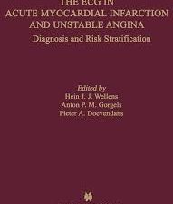the ecg in acute myocardial infarction and unstable angina: diagnosis and risk stratification (developments in cardiovascular medicine book 245) 2002nd edition