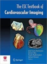The ESC Textbook of Cardiovascular Imaging 2009th Edition
