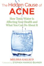 the hidden cause of acne: how toxic water is affecting your health and what you can do about it, 2nd edition