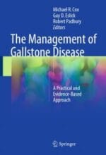 the management of gallstone disease: a practical and evidence based approach