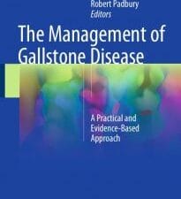 the management of gallstone disease: a practical and evidence based approach