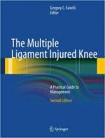 the multiple ligament injured knee: a practical guide to management edition 2