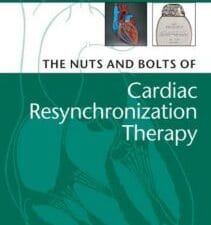 The Nuts and Bolts of Cardiac Resynchronization Therapy